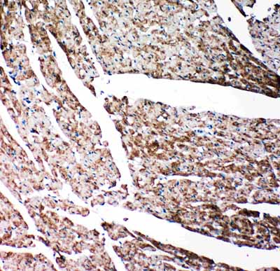 IHC - Anti-Gelsolin Antibody ABO11415